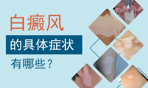 杭州哪里治白癜风 白癜风的出现对患者有什么危害?