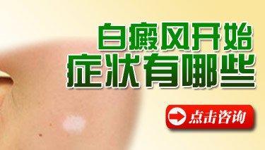 杭州治疗白癜风，如何正确的治疗白癜风?