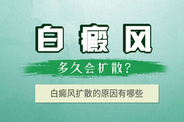 金华治疗白癜风最好医院 患白癜风一般多久会扩散?