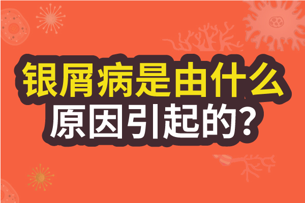 引发白癜风的病因有哪些?